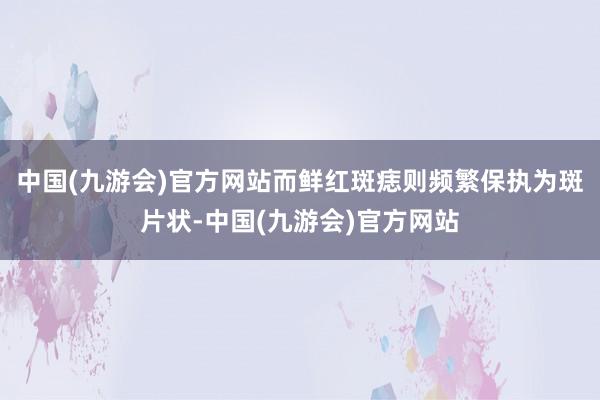 中国(九游会)官方网站而鲜红斑痣则频繁保执为斑片状-中国(九游会)官方网站